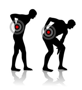 Sciatica in North Myrtle Beach SC