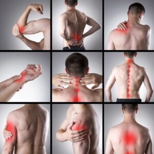 Neck and Arm Pain