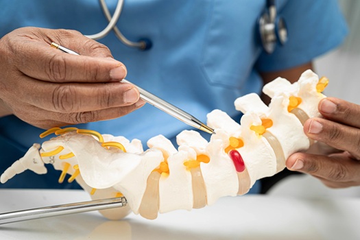 herniated disc in North Myrtle Beach