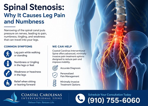 spinal stenosis in North Myrtle Beach SC | Coastal Carolinas Interventional Spine spinal stenosis in North Myrtle Beach SC