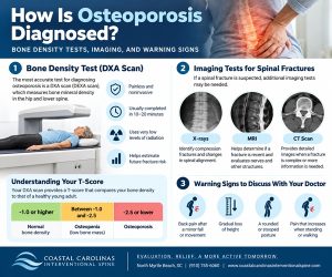 Osteoporosis in North Myrtle Beach SC | Coastal Carolinas Interventional Spine Osteoporosis in North Myrtle Beach SC